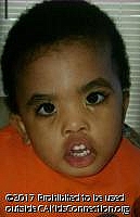 Andre